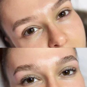 Laminare Gene ORadea